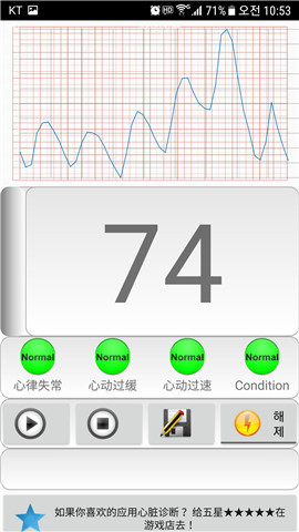 心脏诊断